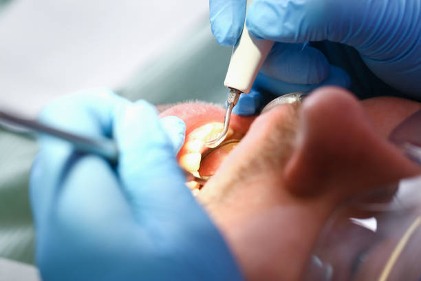 Best Walk-In Emergency Dentist in Five Points, FL